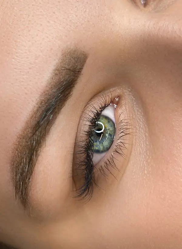 Lower Eyelid Blepharoplasty In Dubai