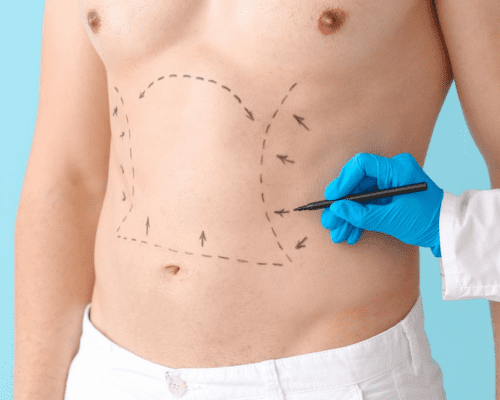 warning signs after liposuction