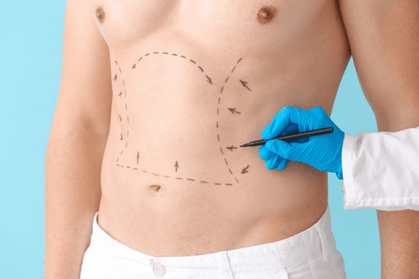 warning signs after liposuction