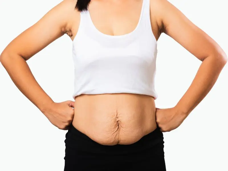 Liposuction vs. Tummy Tuck