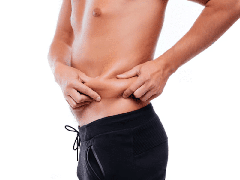 Tummy Tuck for Men