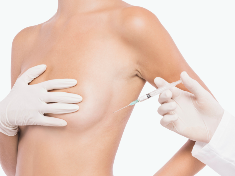 Areola Reduction