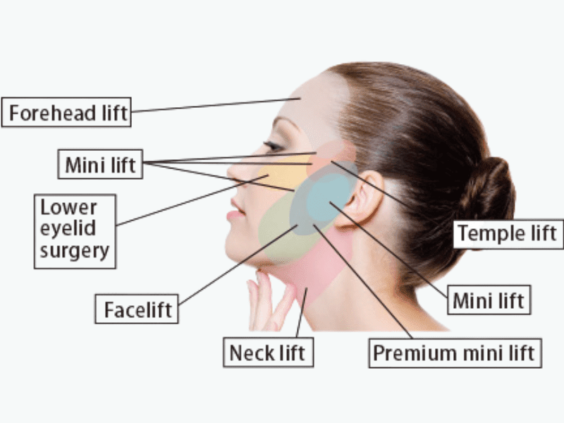 8 Point Facelift in Dubai by Dr Faisal Salim min 1